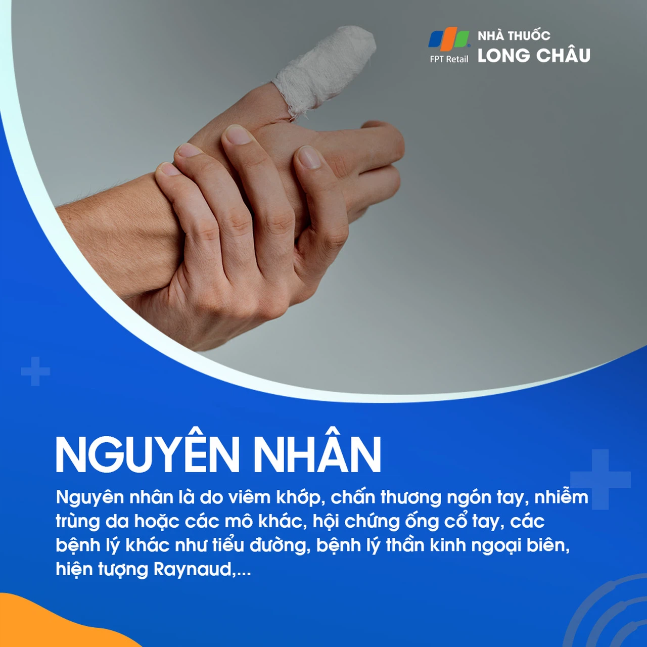 Đau ngón tay 3