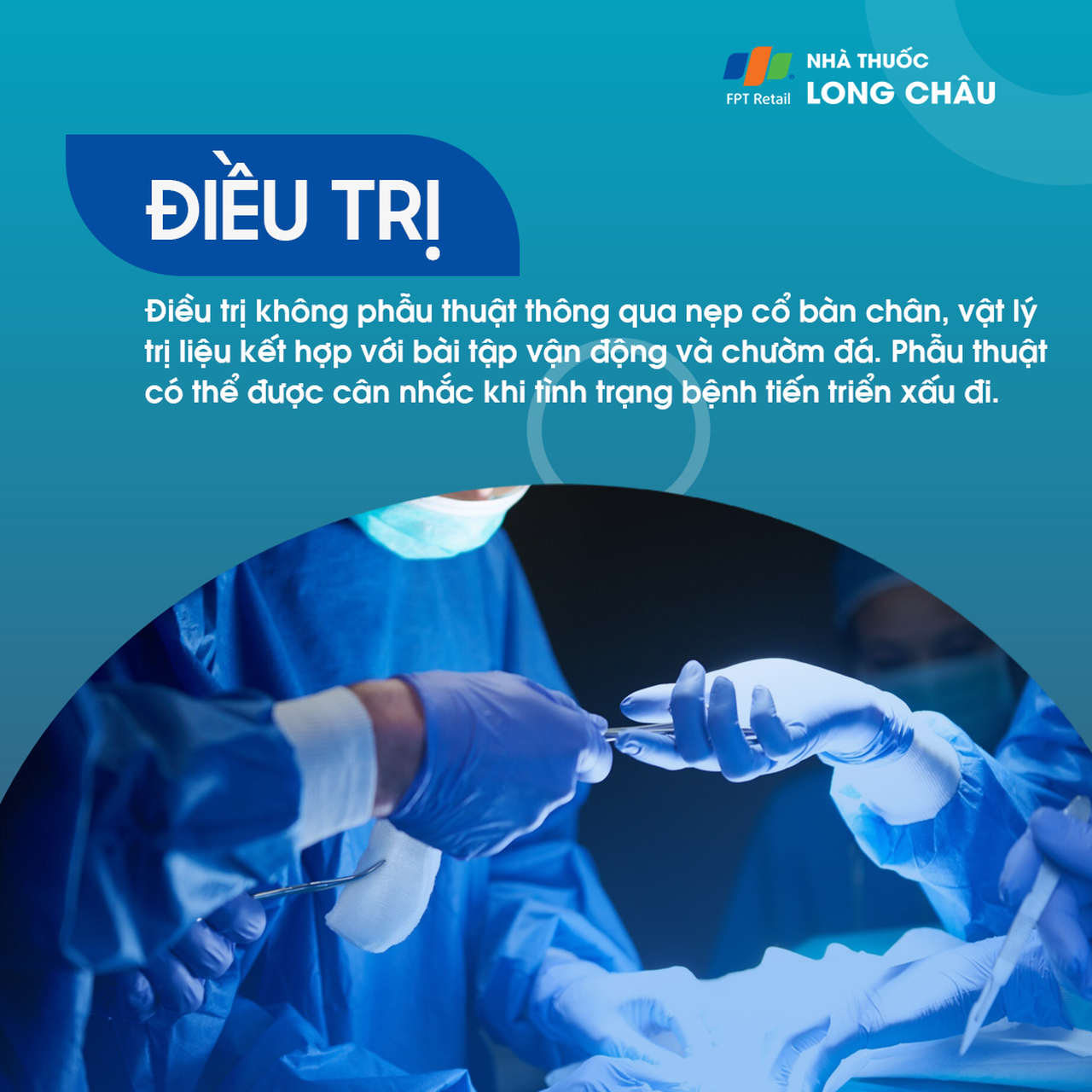 Liệt dây thần kinh hông khoeo ngoài 6