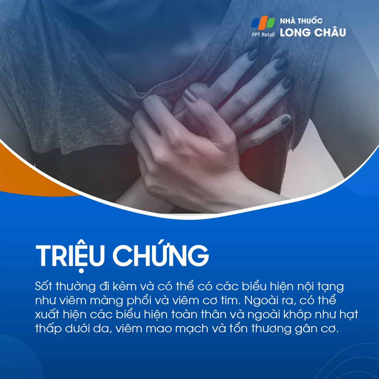 Thấp khớp 3