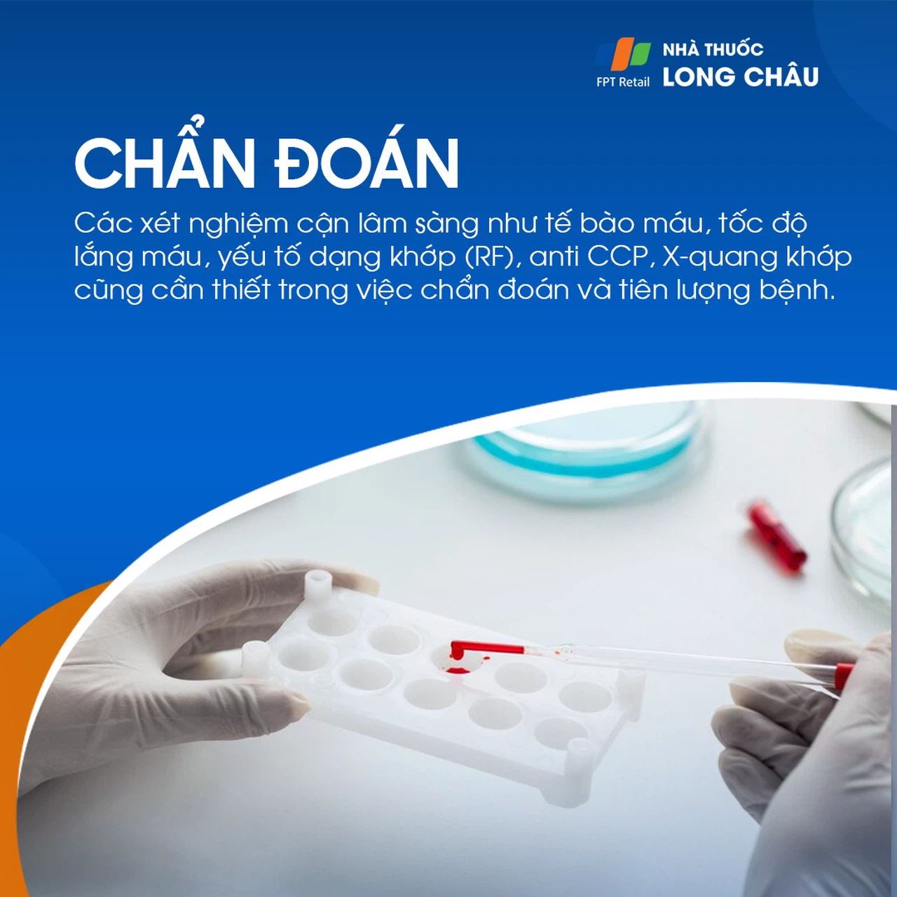 Thấp khớp 8