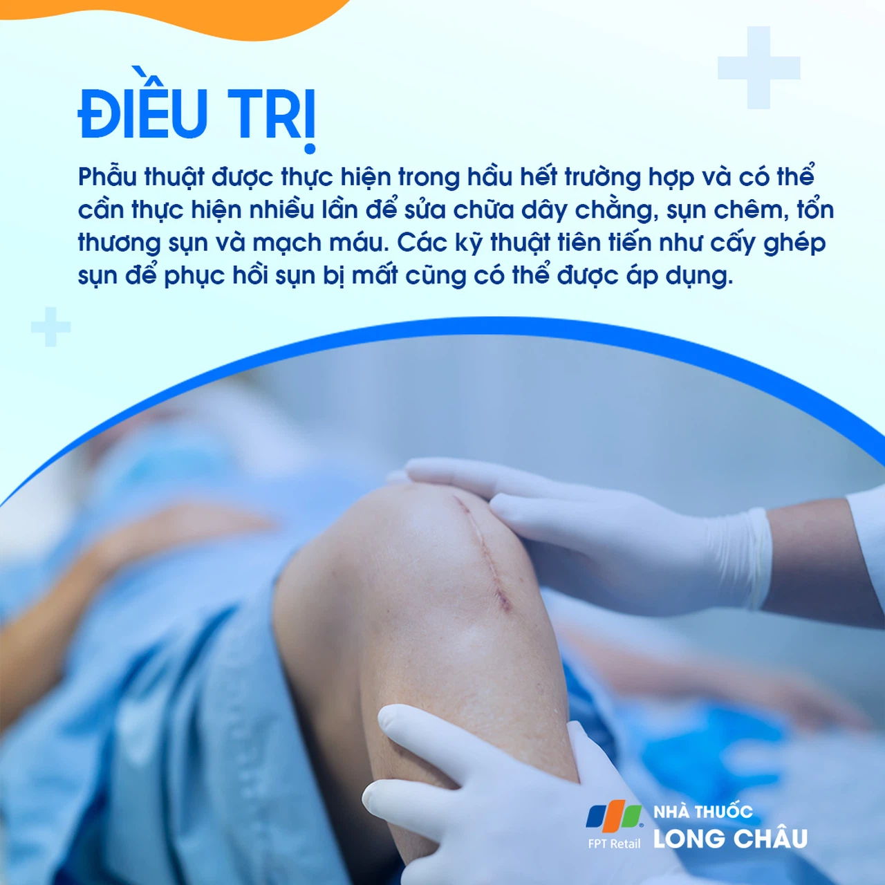 Trật khớp gối 8
