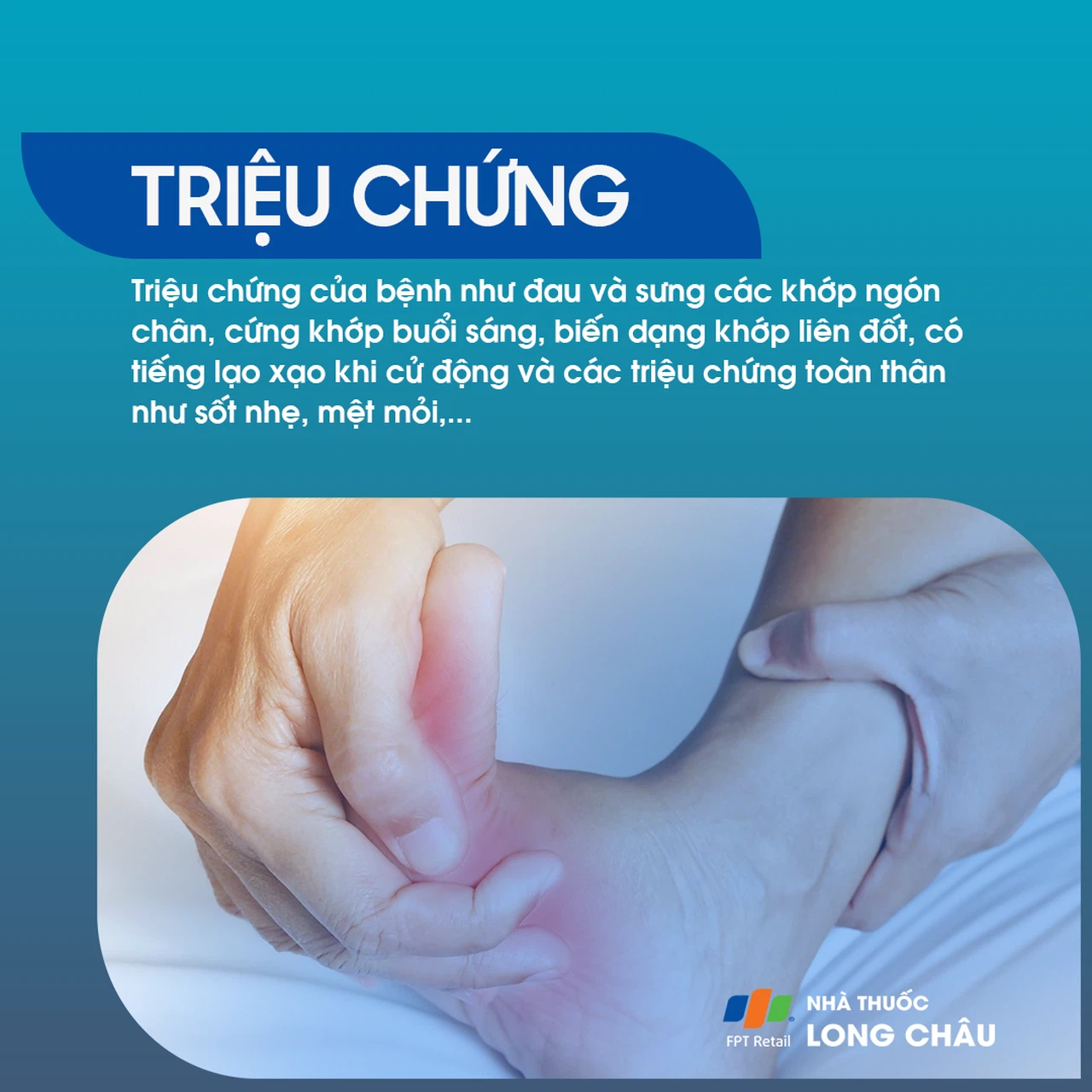 Viêm khớp ngón chân 2