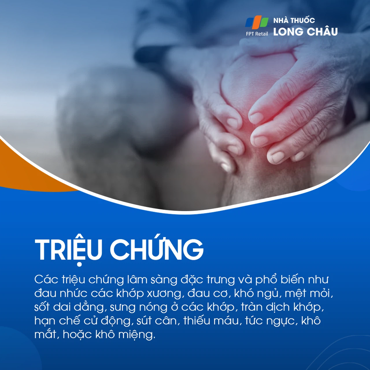 Viêm khớp tự miễn 3