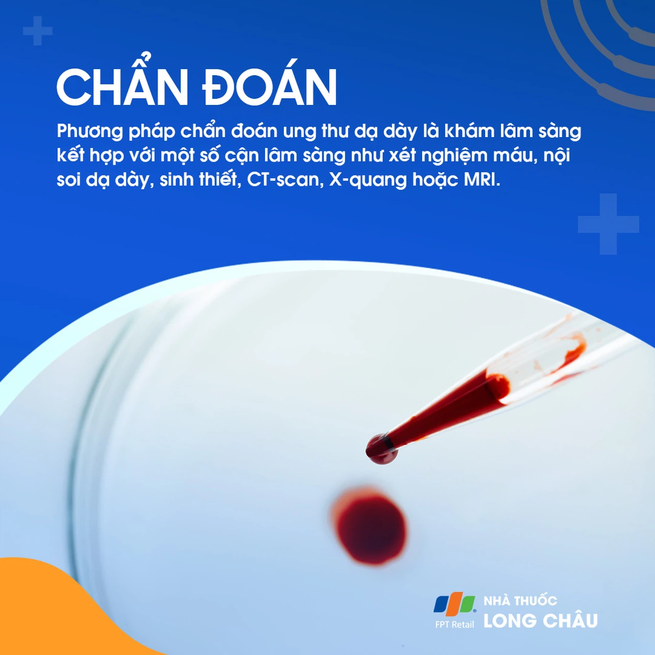 Ung thư dạ dày 5