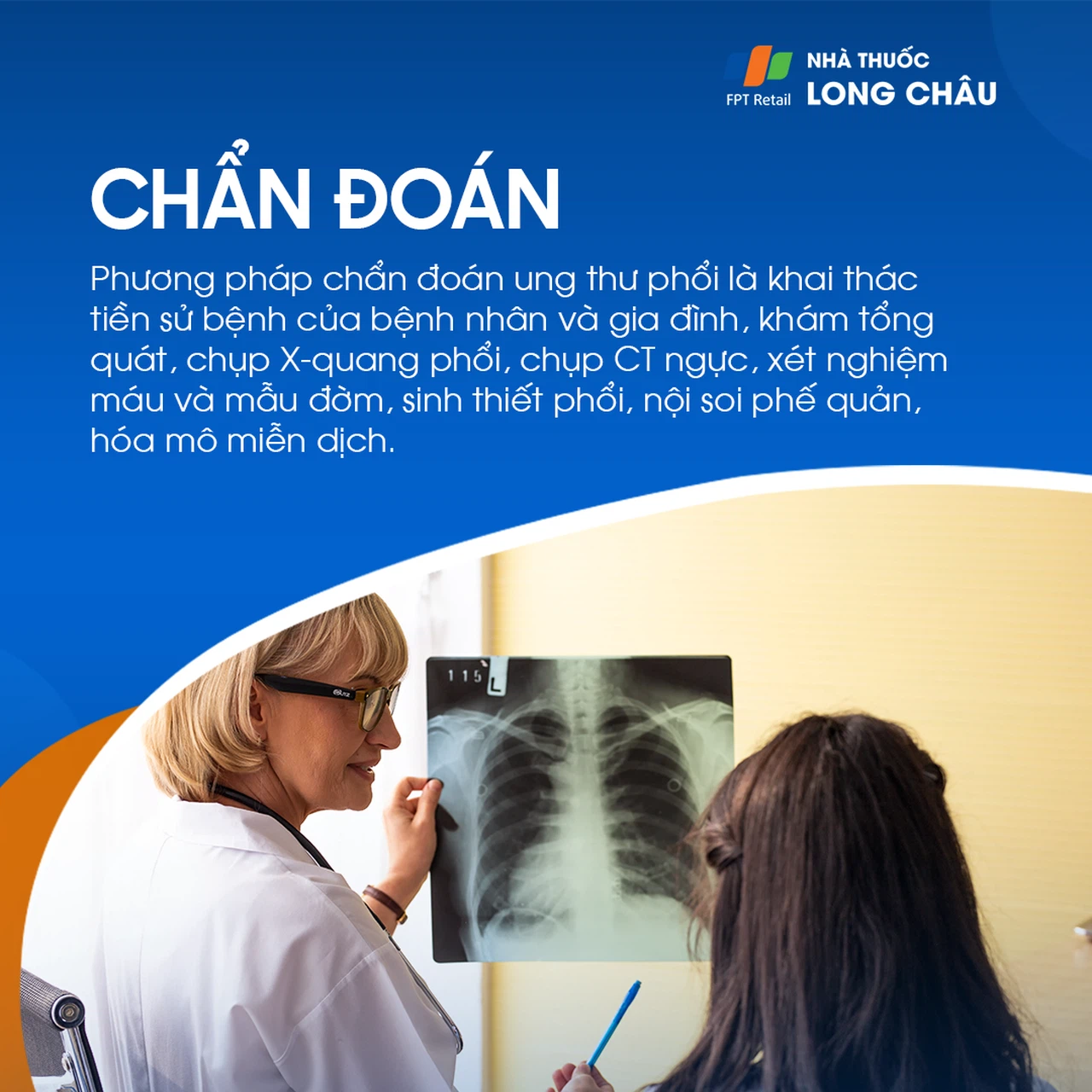 Ung thư phổi 5