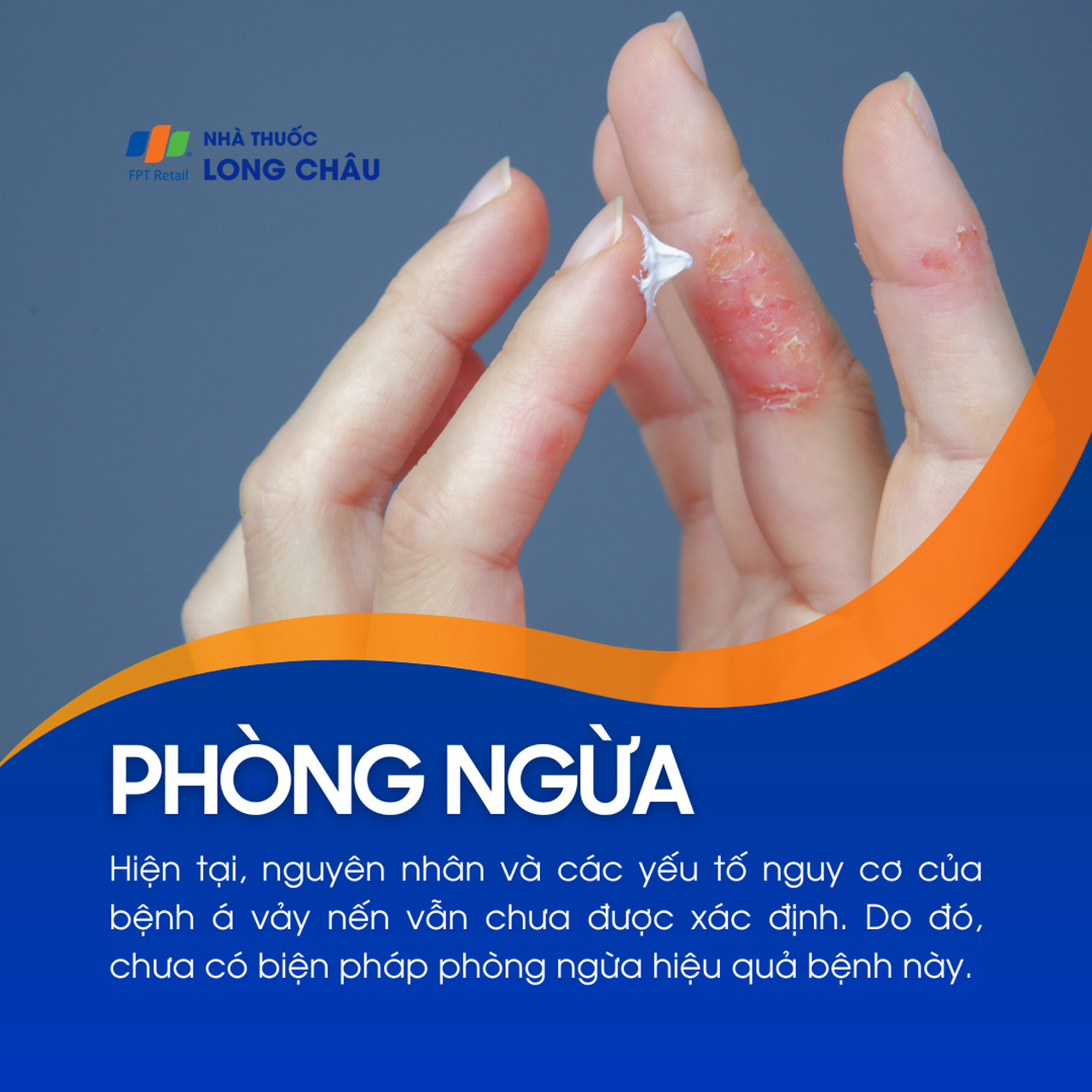 Á vảy nến 7