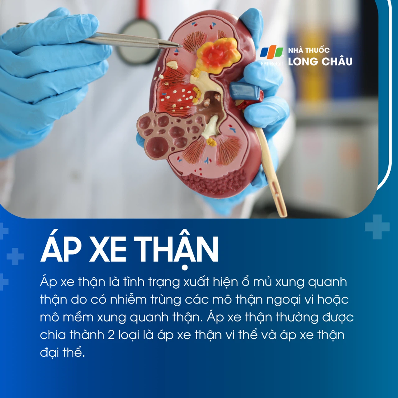 Áp xe thận 1