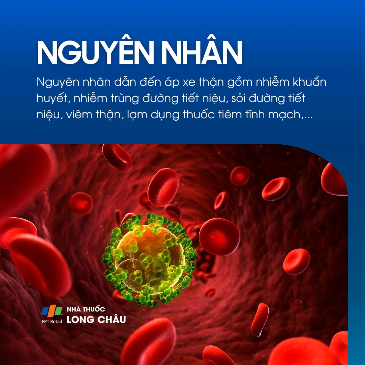 Áp xe thận 3
