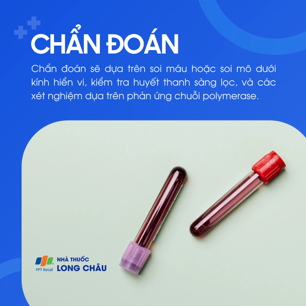 Bệnh chagas 5