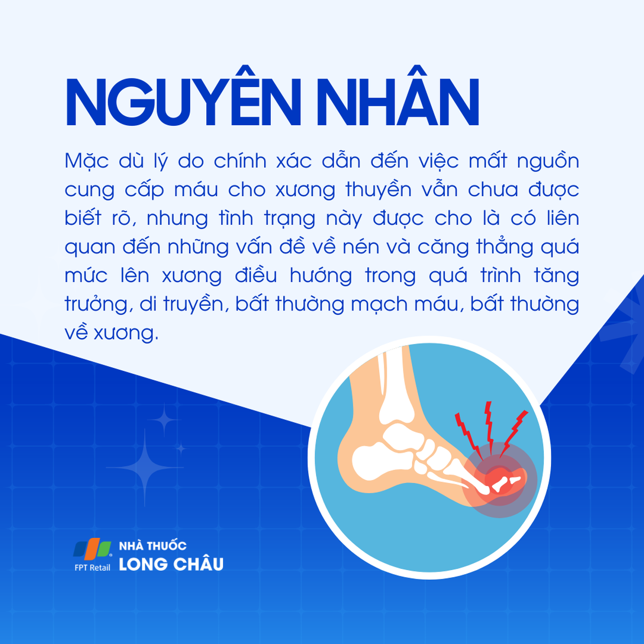 Bệnh Kohler 3