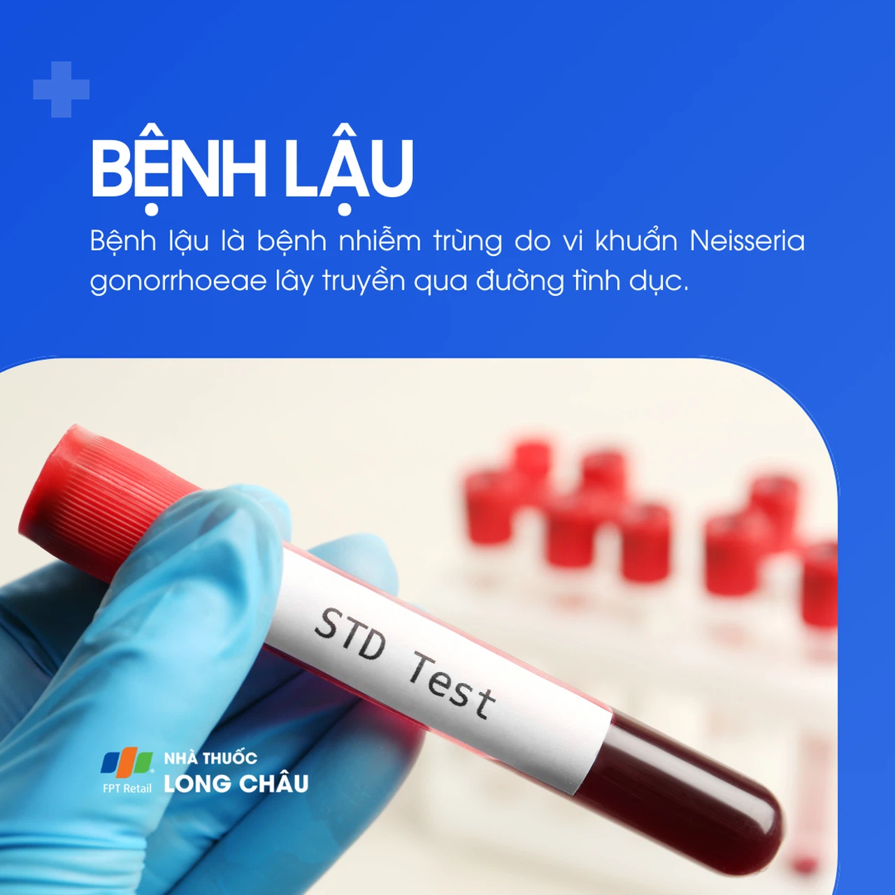 Bệnh lậu 1