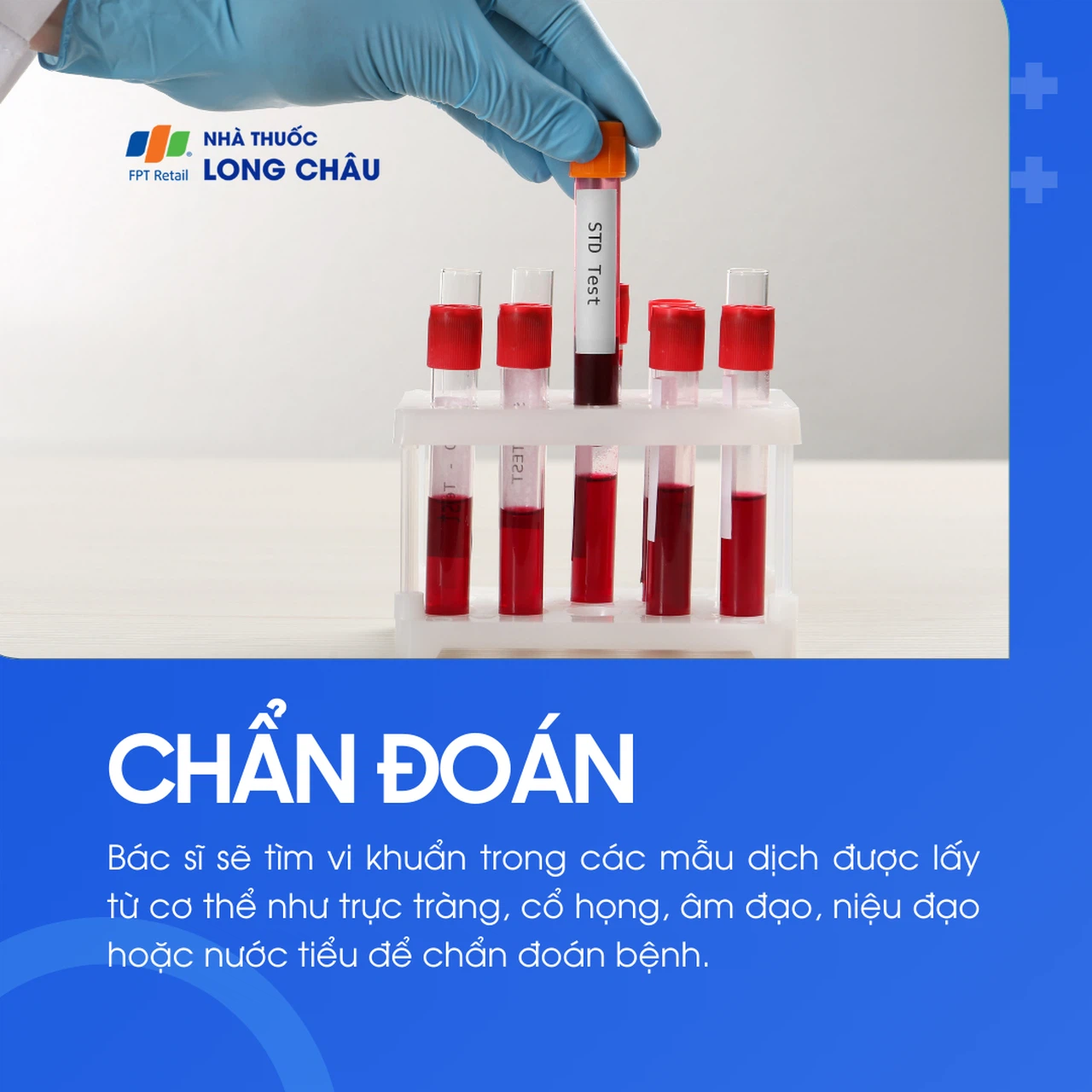 Bệnh lậu 5
