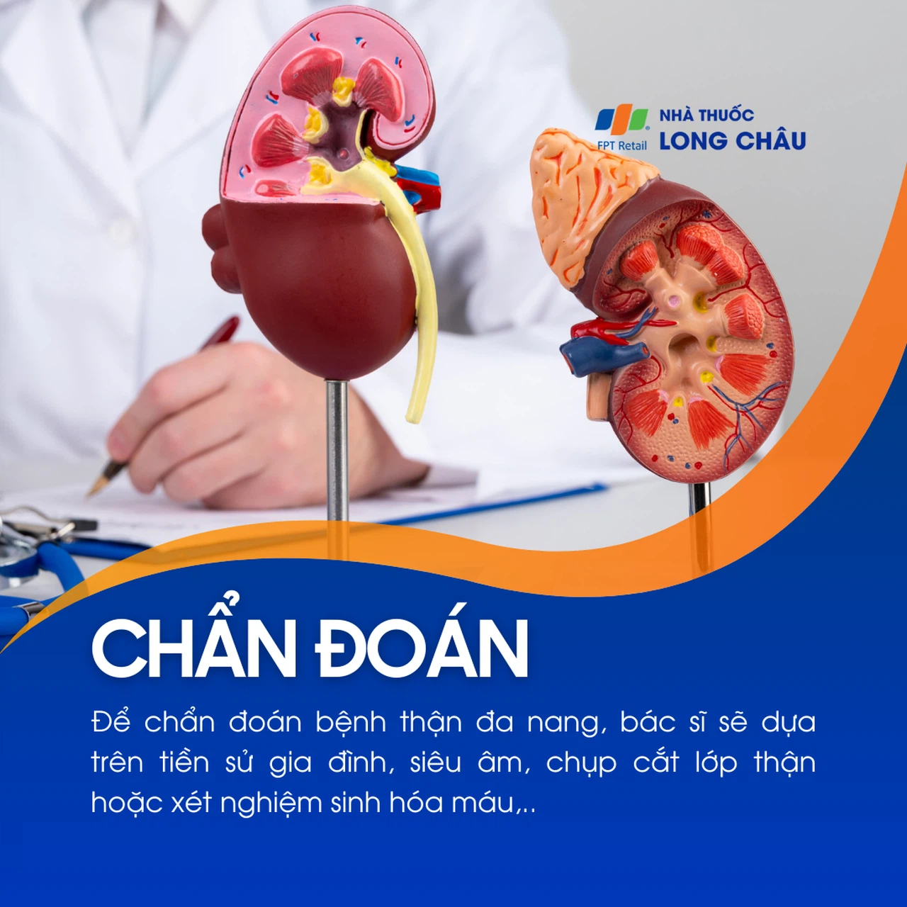 Thận đa nang 5