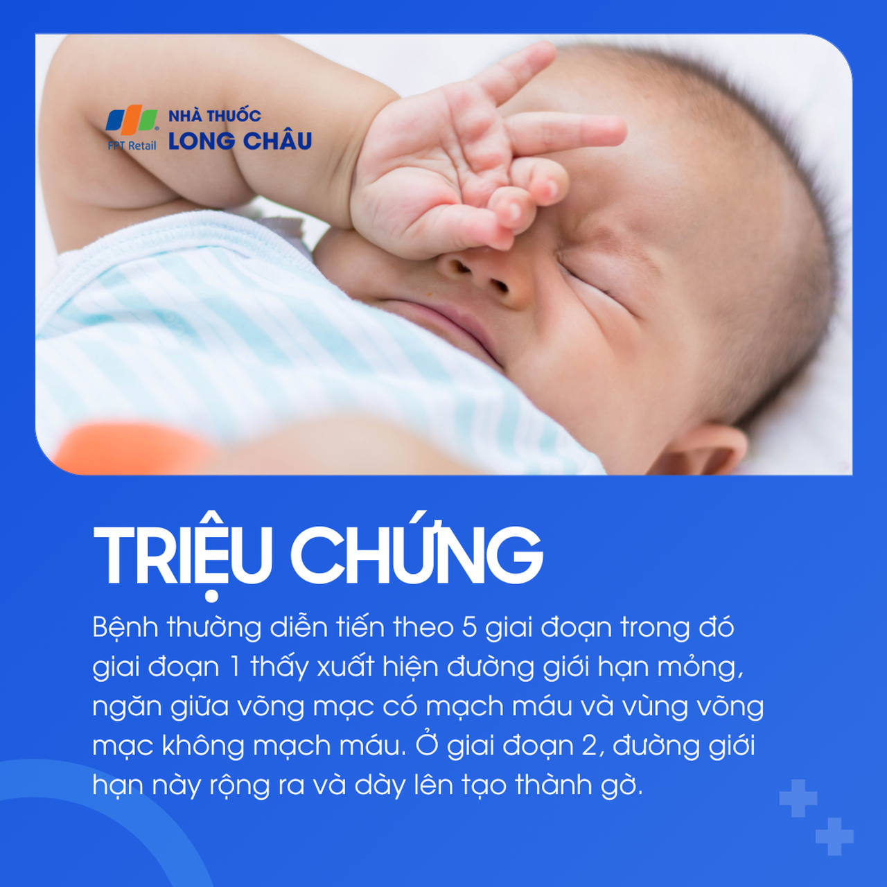 Bong võng mạc trẻ sinh non 2