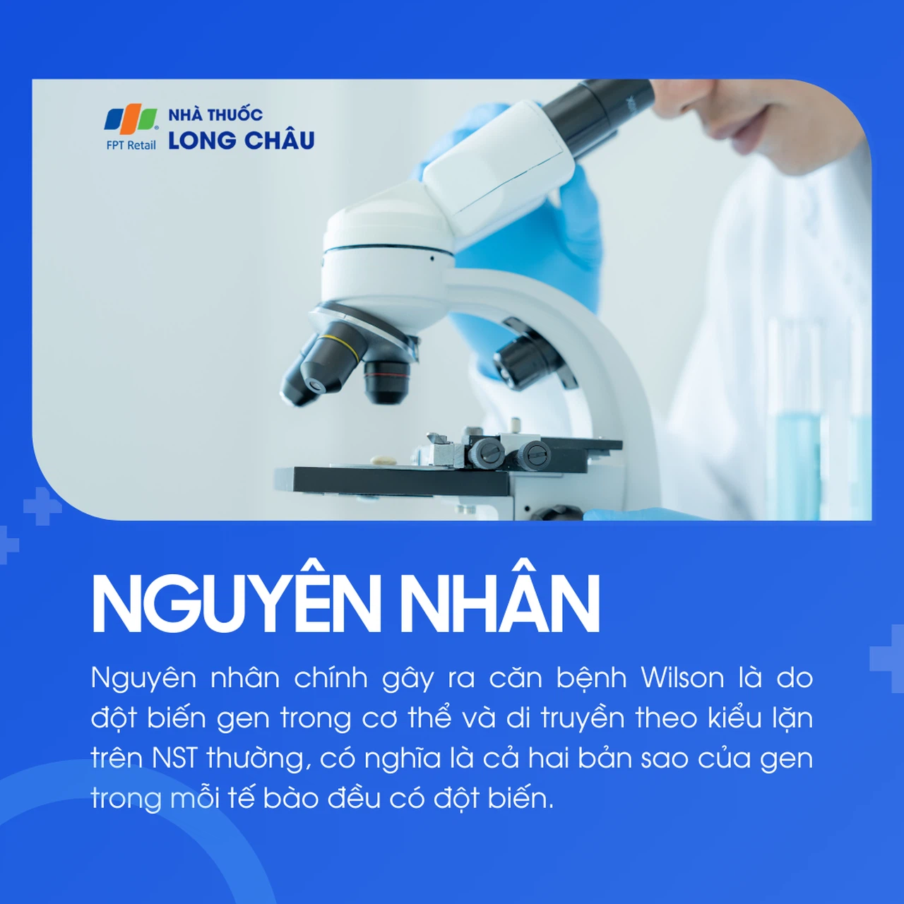 Bệnh Wilson 3