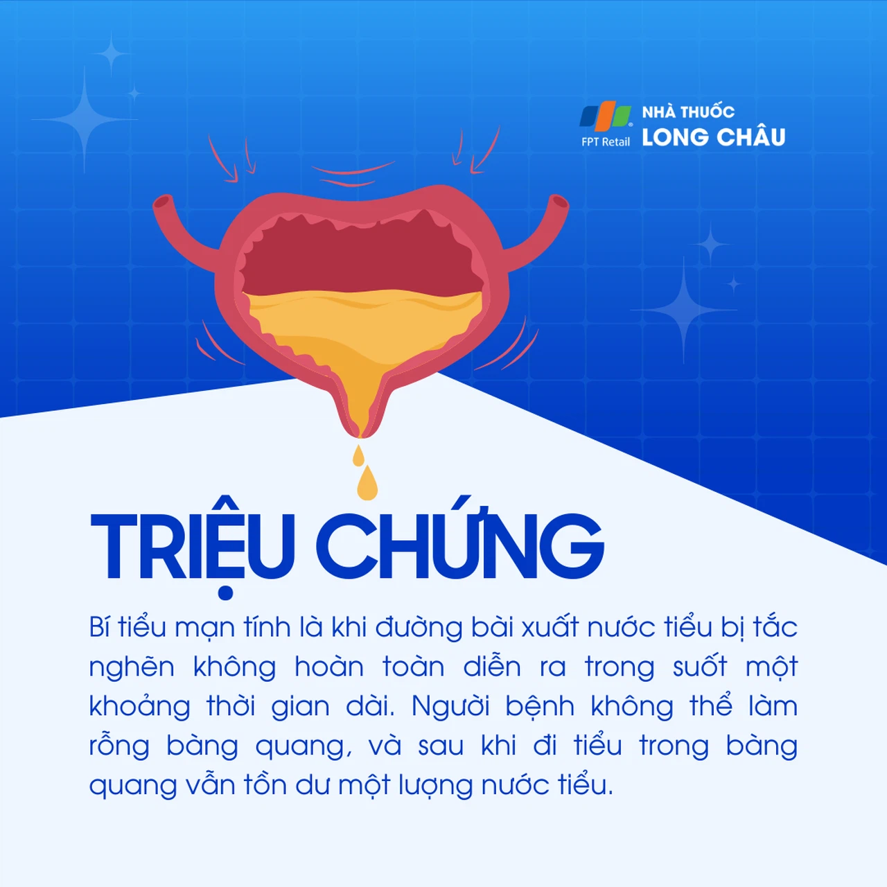 Bí tiểu 3