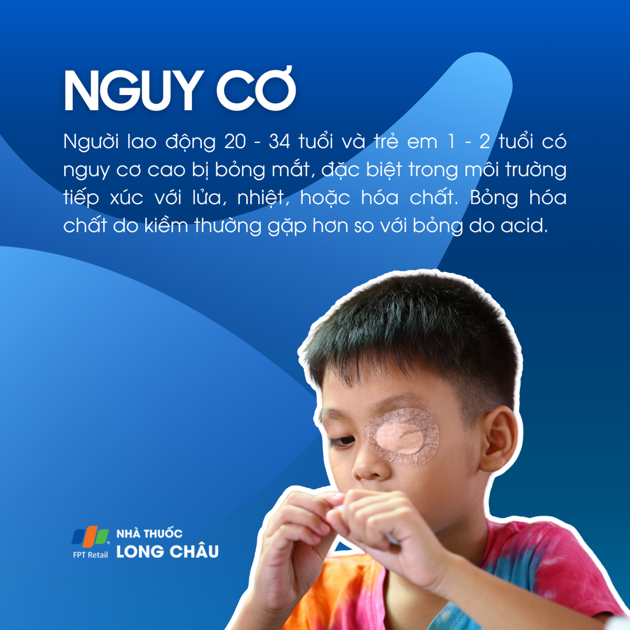 Bỏng mắt 4