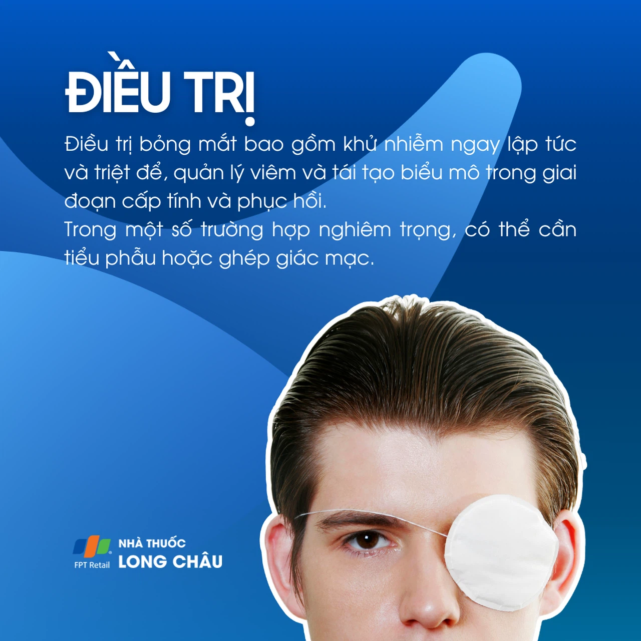 Bỏng mắt 6