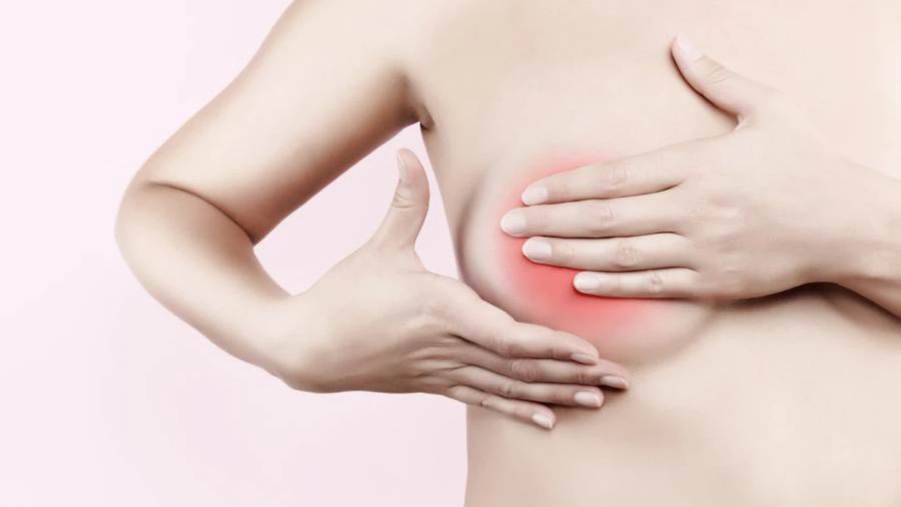 Bướu sợi tuyến Birads 4 là gì? Nguyên nhân, triệu chứng và phương pháp điều trị 3
