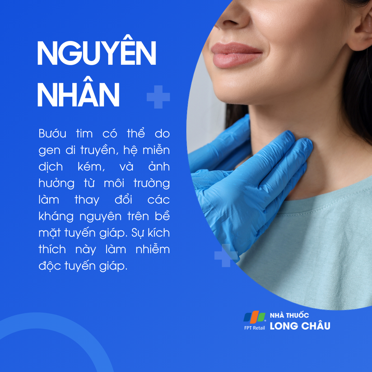 Bướu tim 3