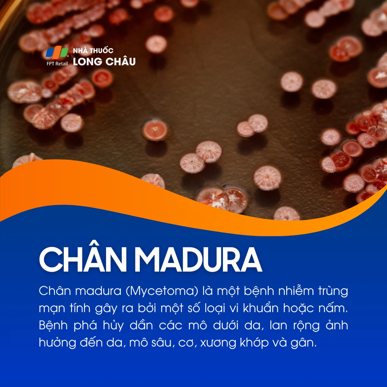 Chân Madura 1