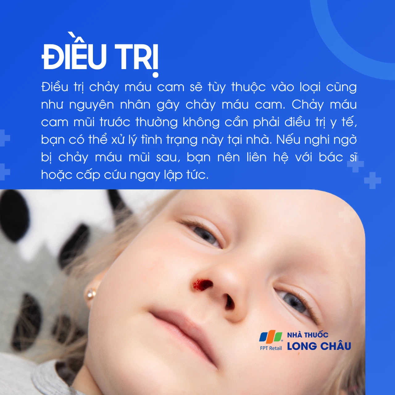 Chảy máu cam 6