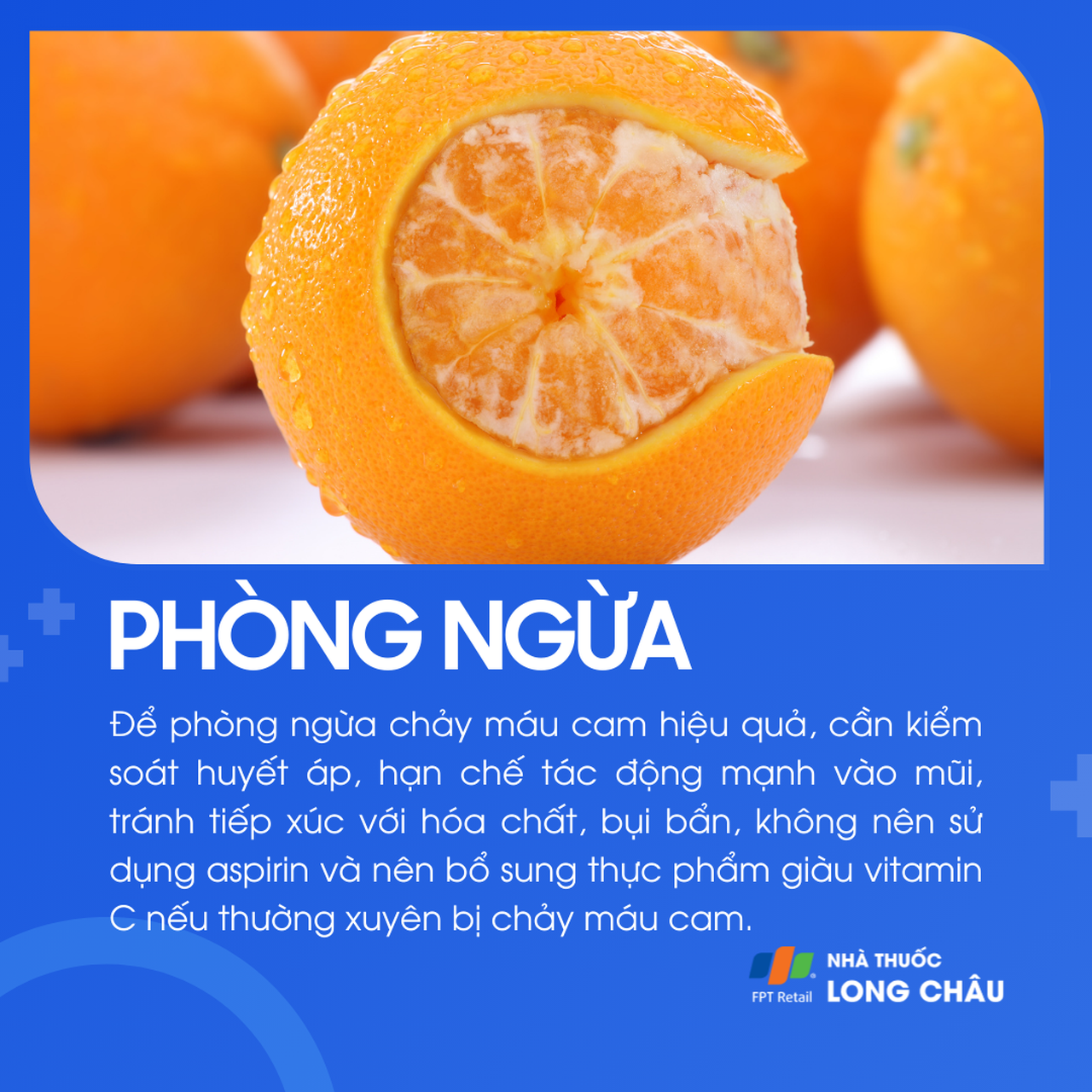 Chảy máu cam 7