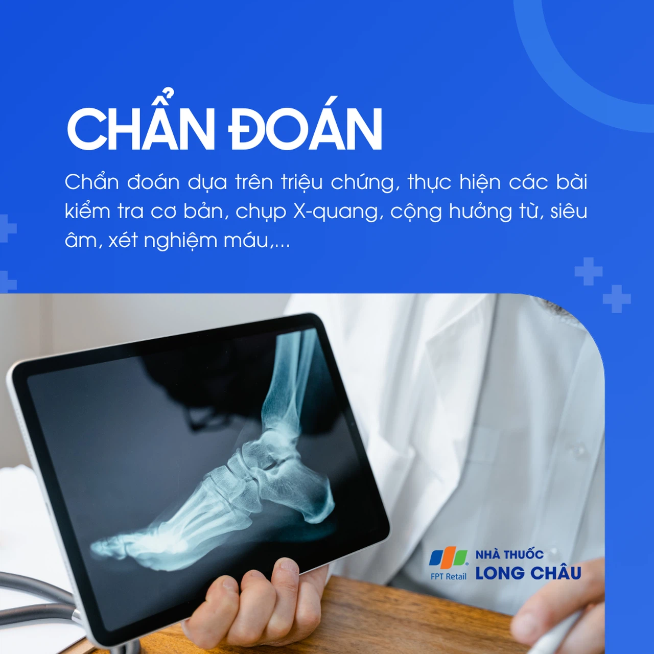 Đau bàn chân 4