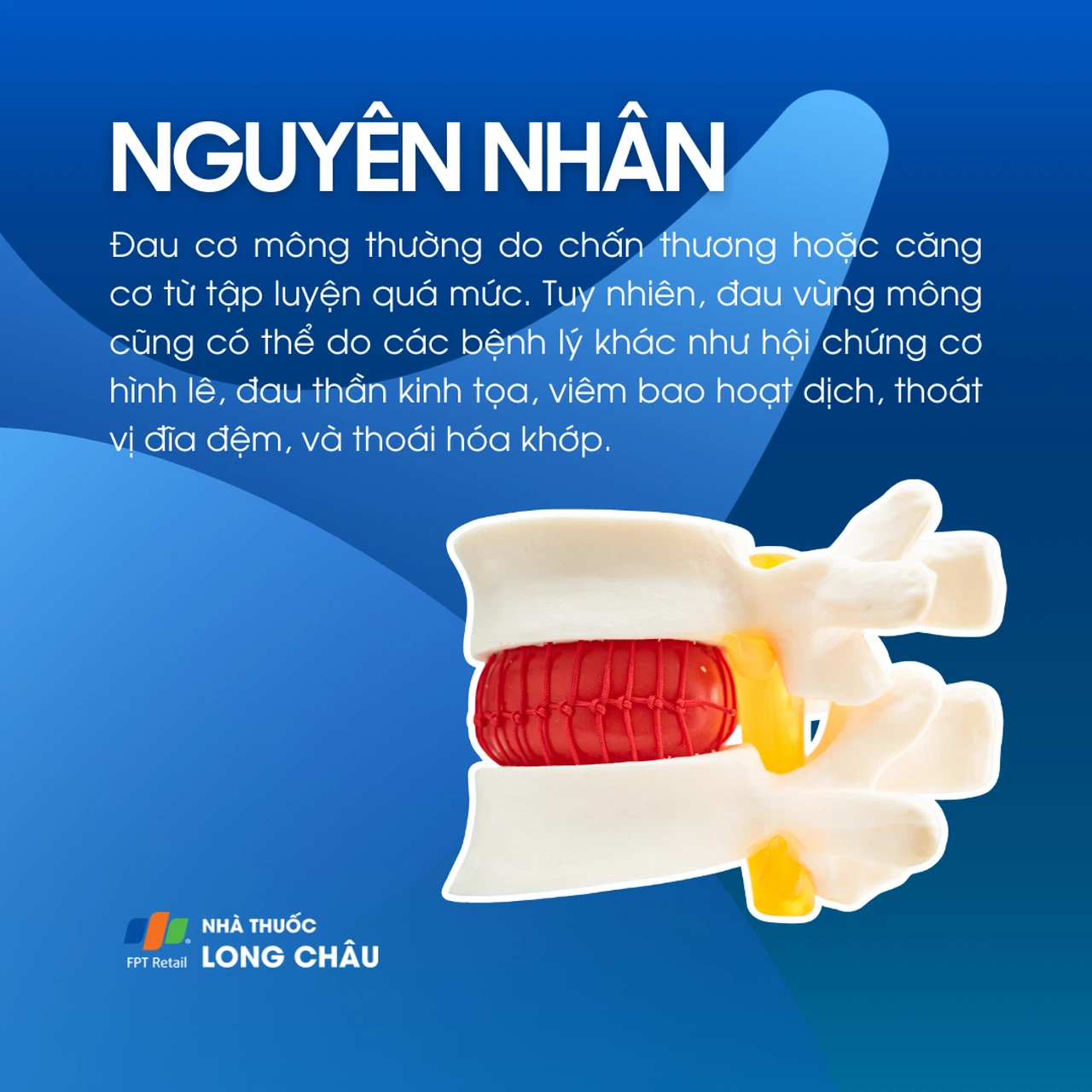 Đau cơ mông 3