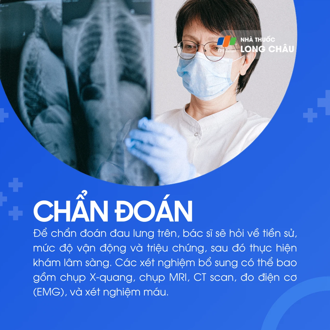 Đau lưng trên 5