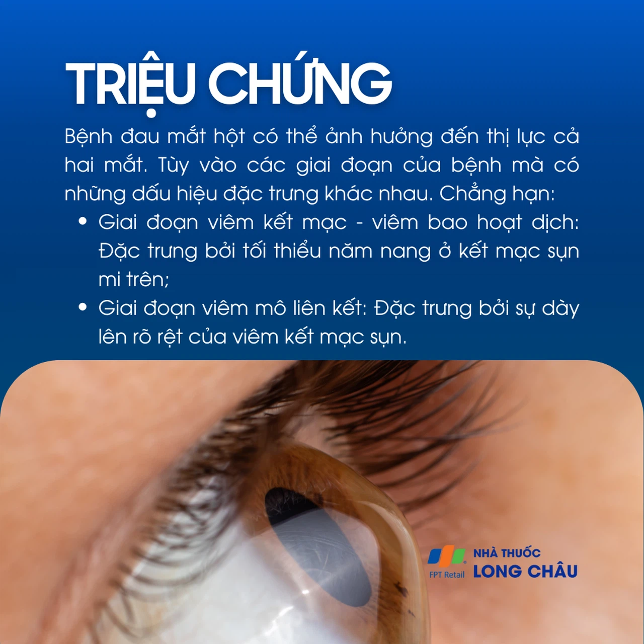 Đau mắt hột 2