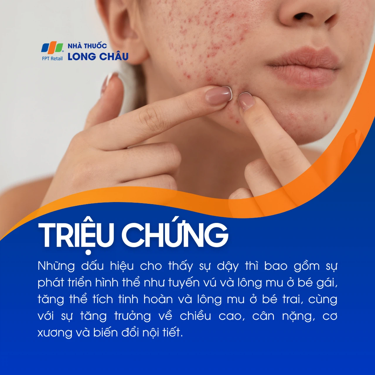Dậy thì 2