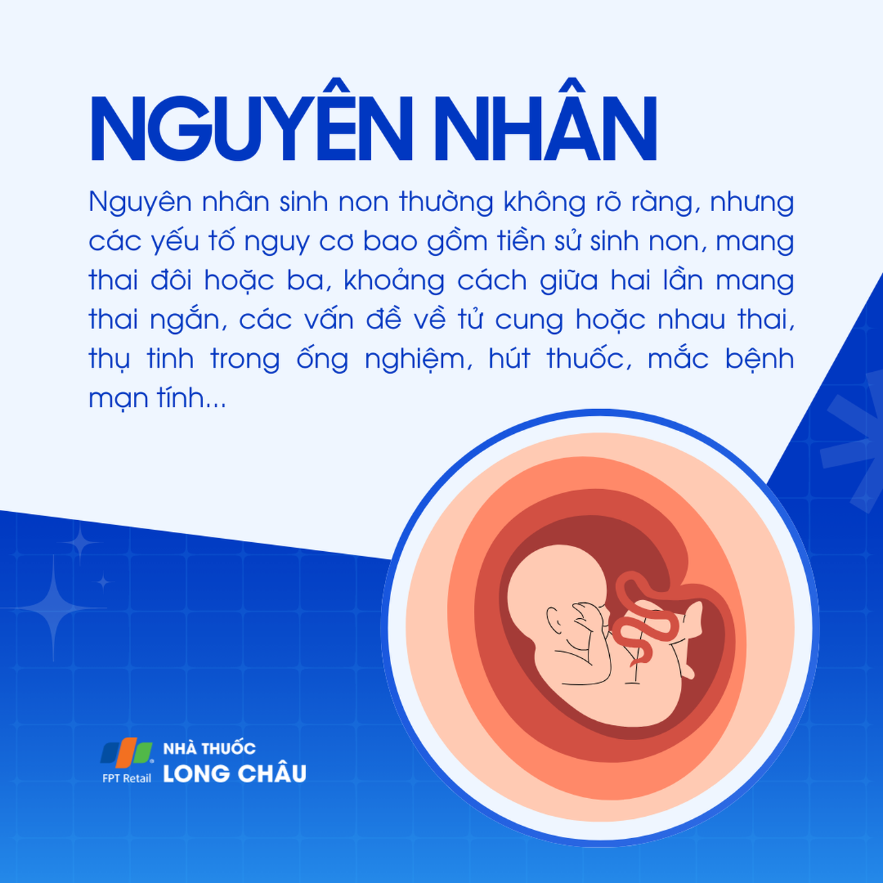 Đẻ non 3