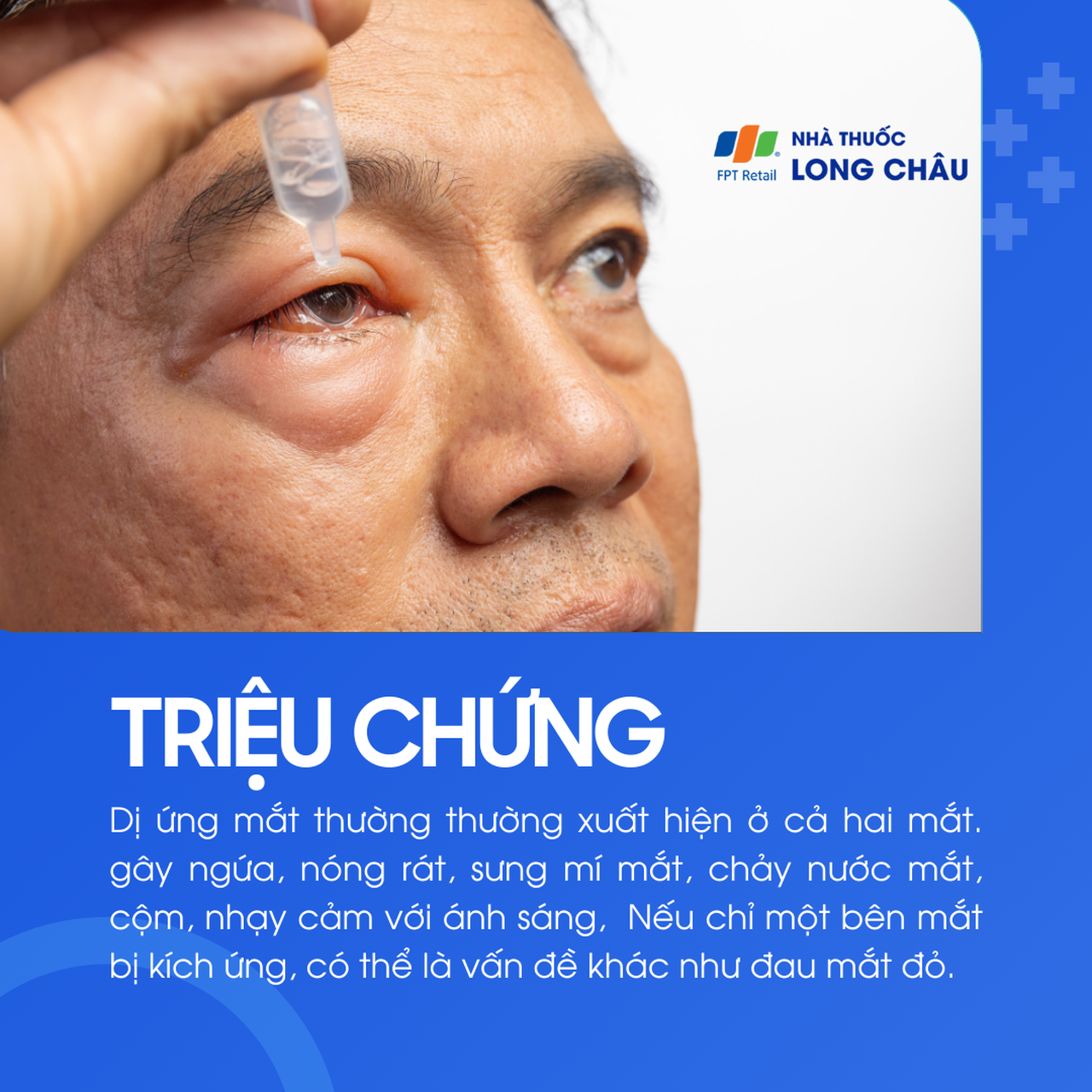 Dị ứng mắt 2