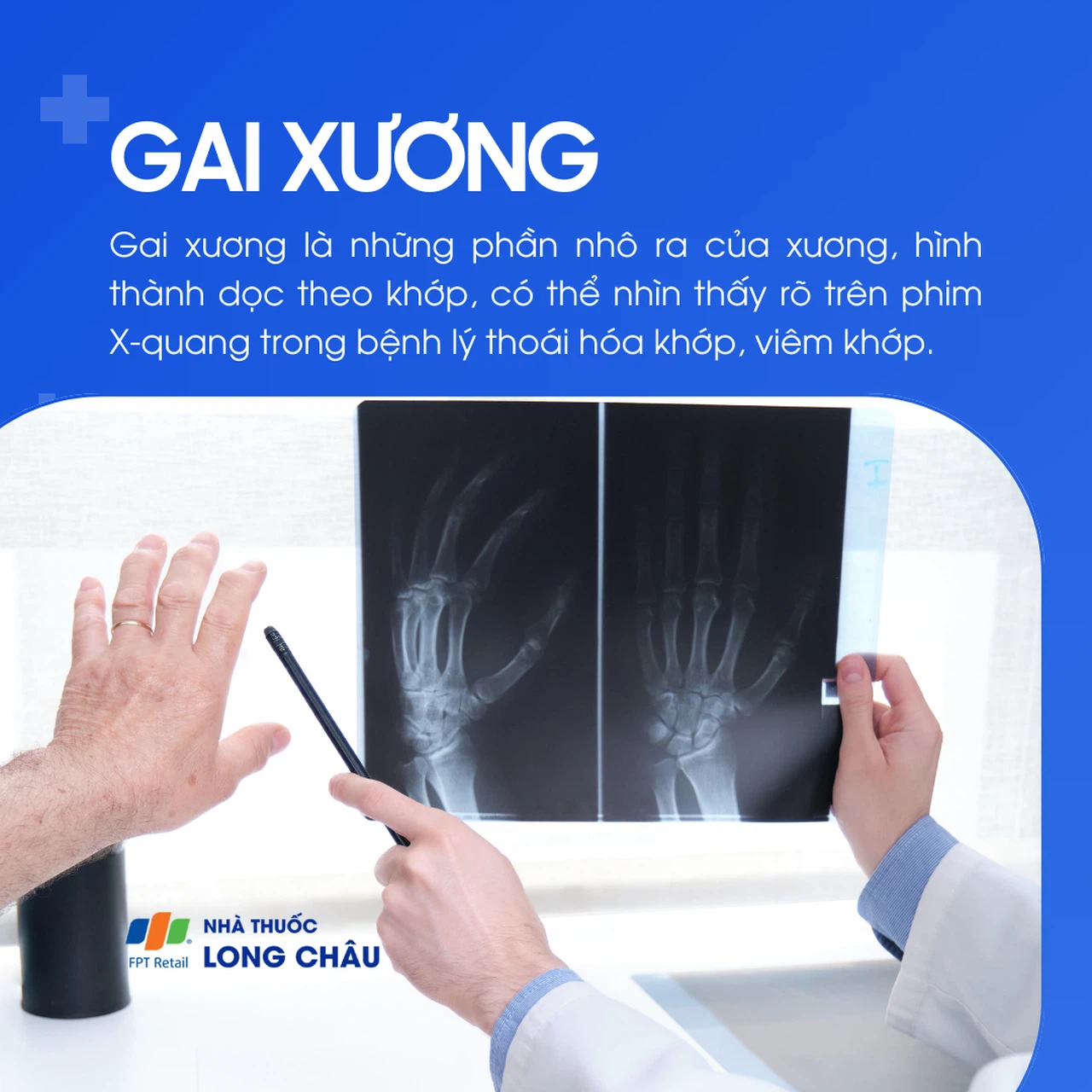 Gai xương 1