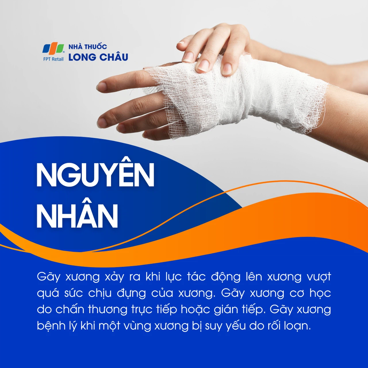 Gãy xương 3