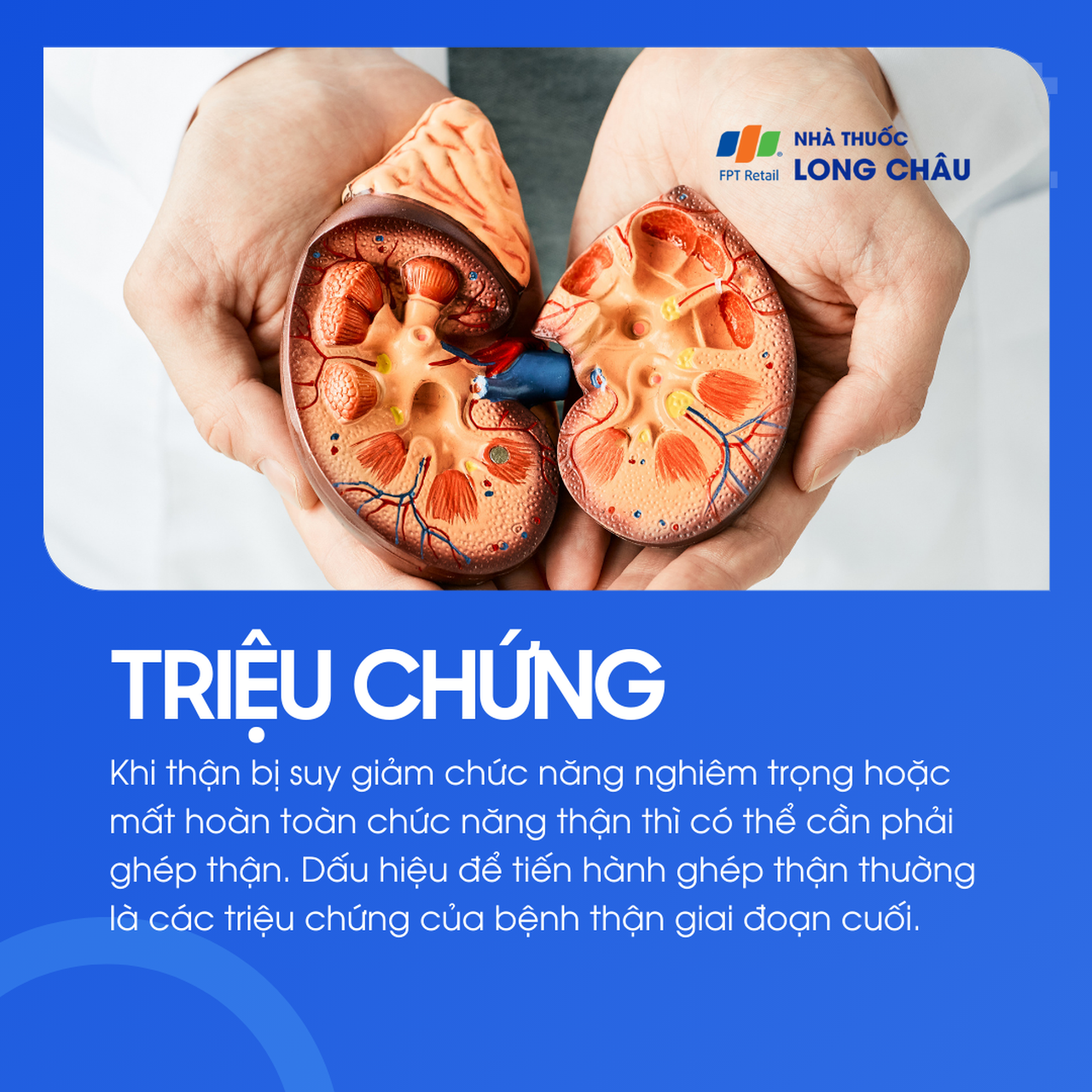 Ghép thận 2