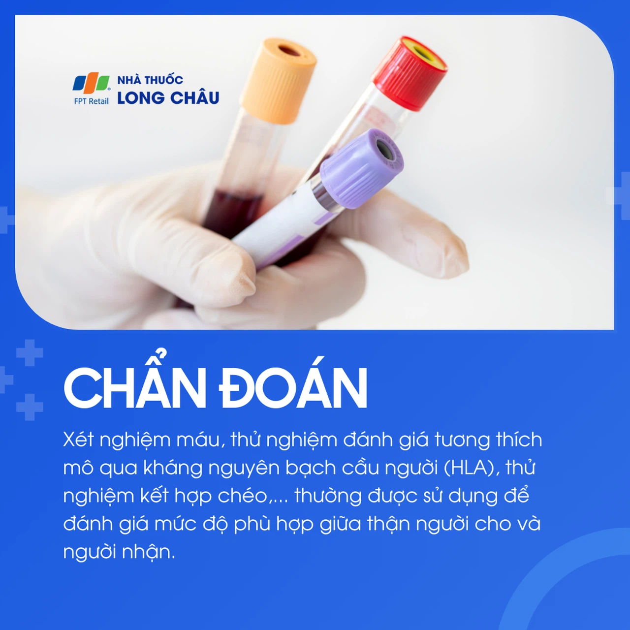 Ghép thận 5