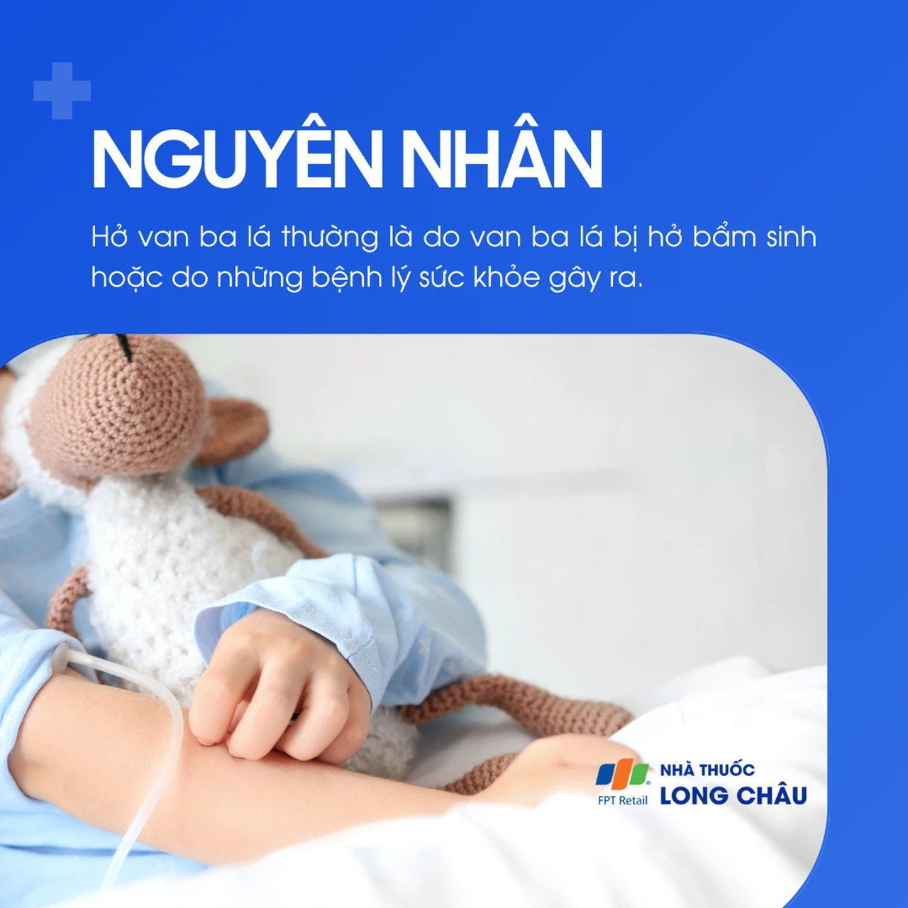 Hở van ba lá 3