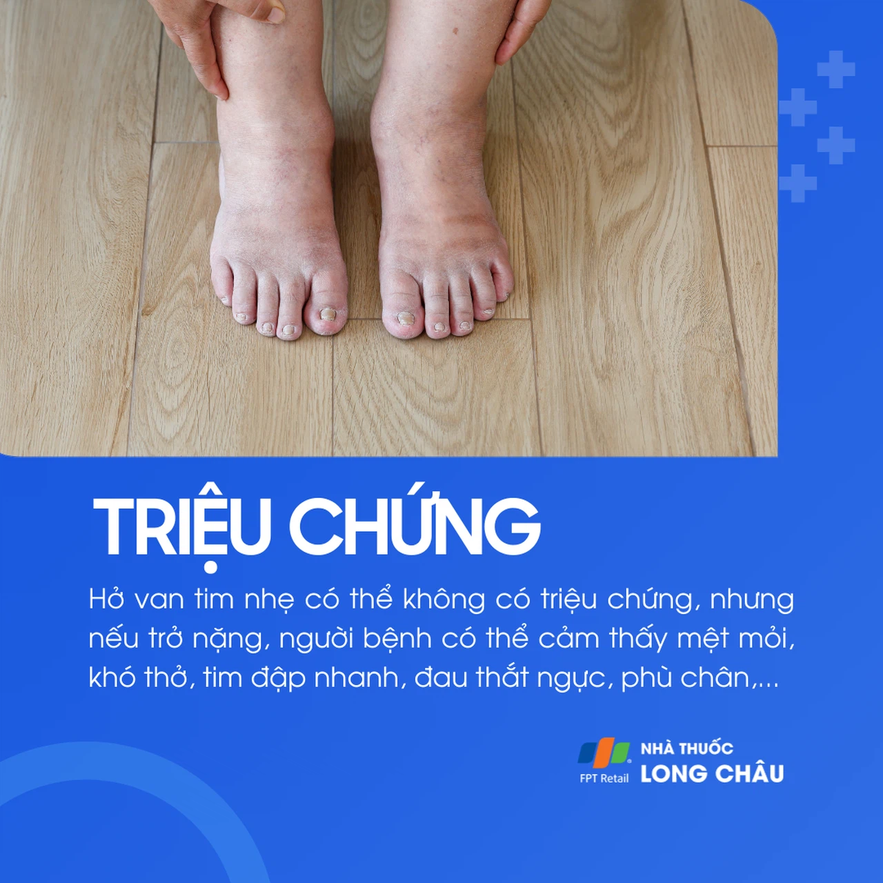 Hở van hai lá 2