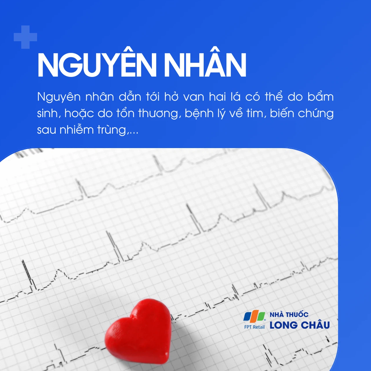 Hở van hai lá 3