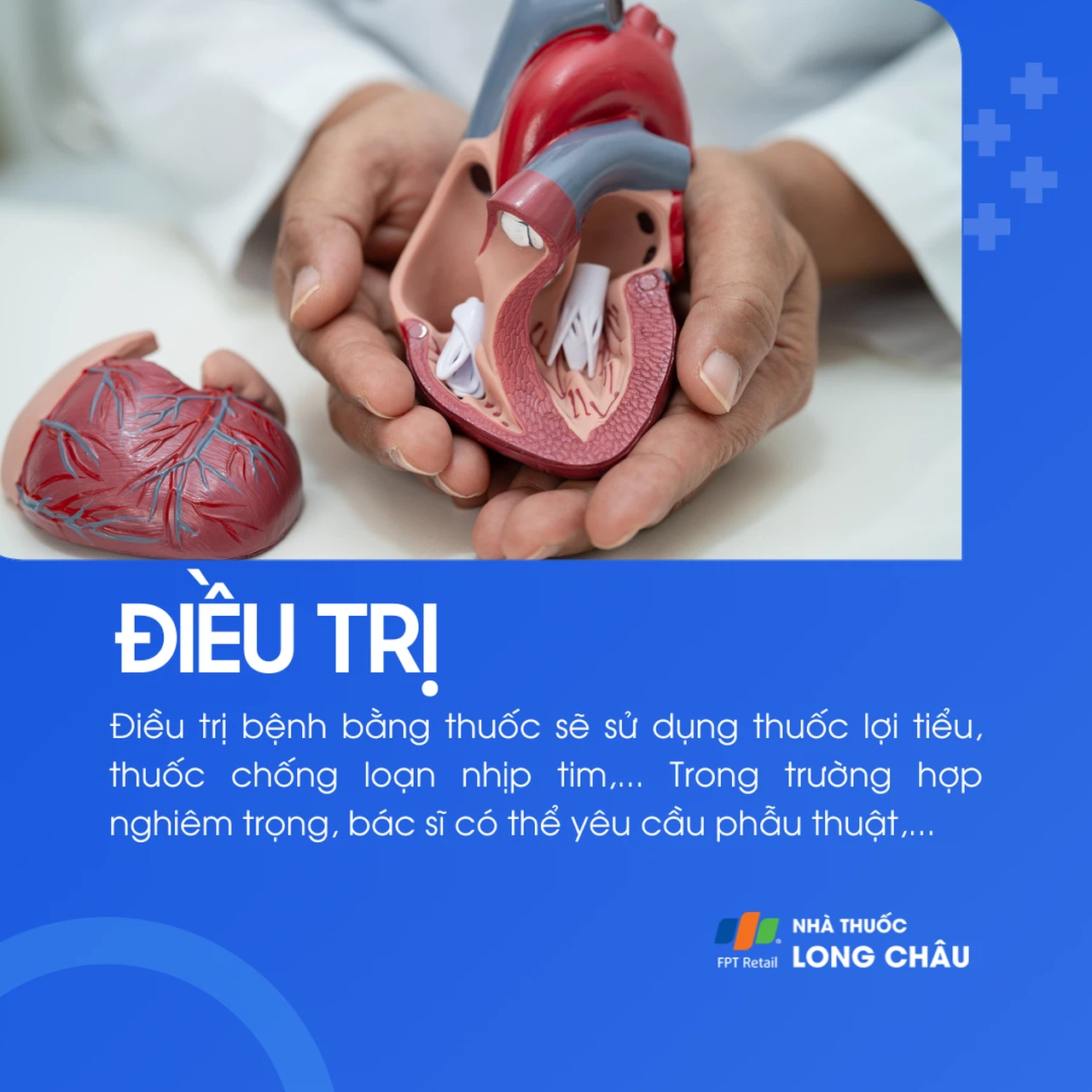 Hở van hai lá 6