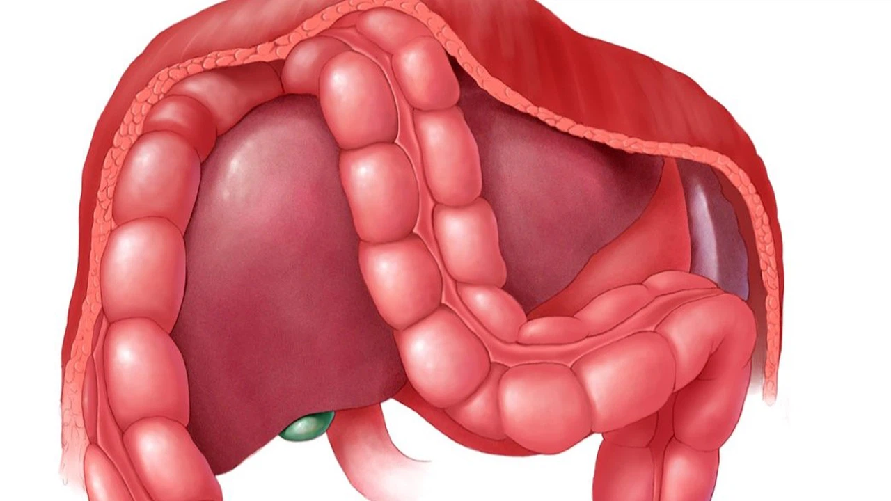 Hội chứng Chilaiditi và những điều cần biết