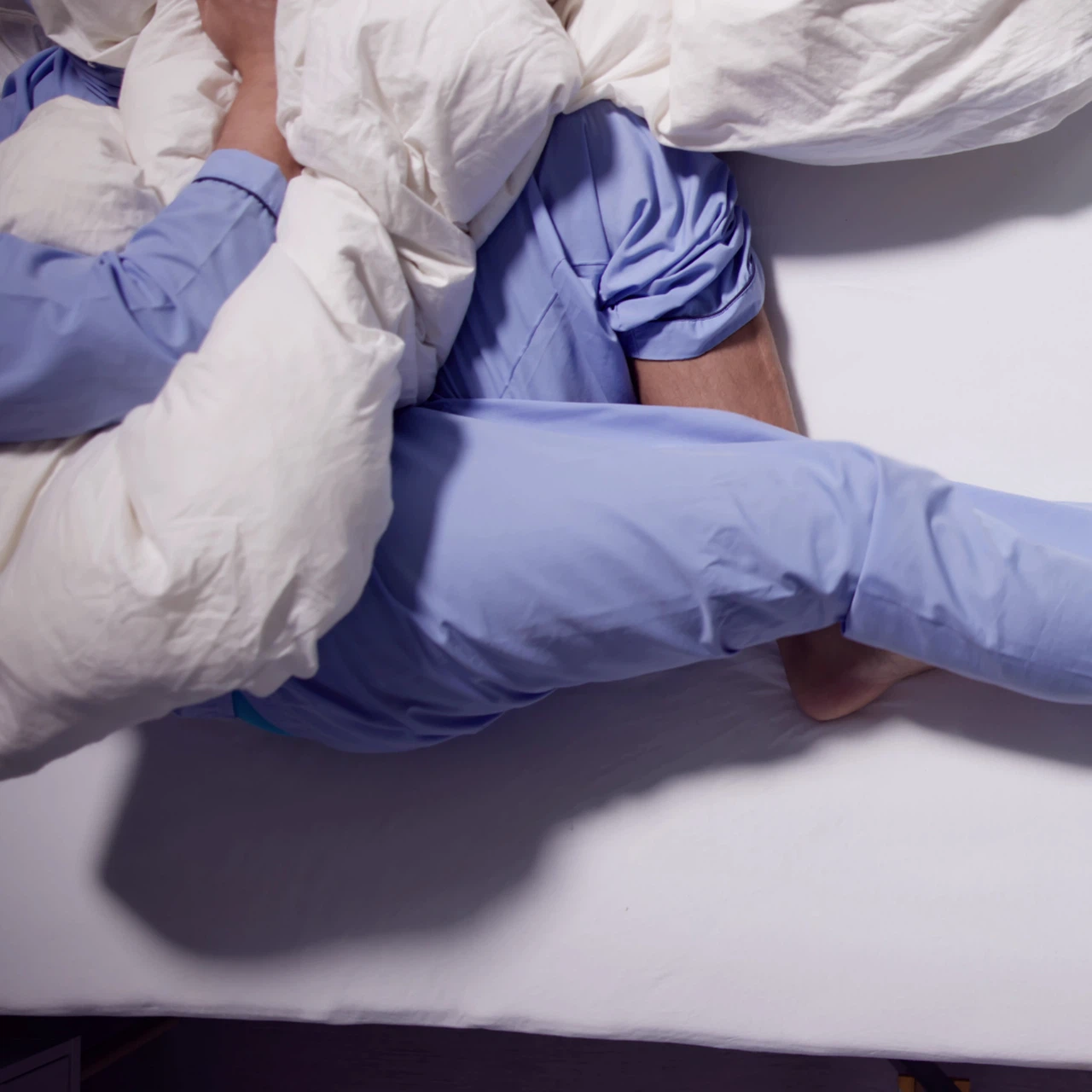 Hội chứng Klinefelter 3