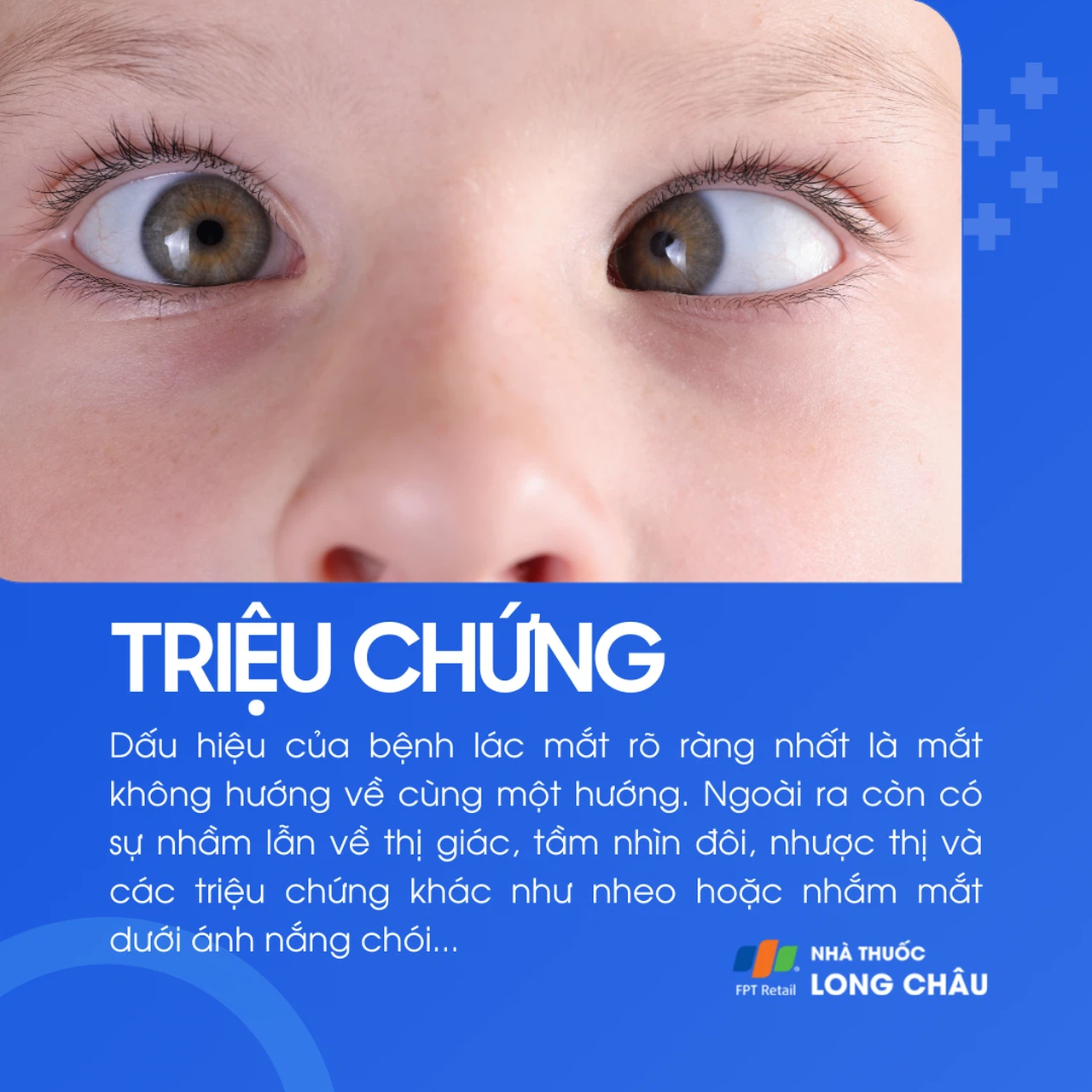 Lác mắt 2