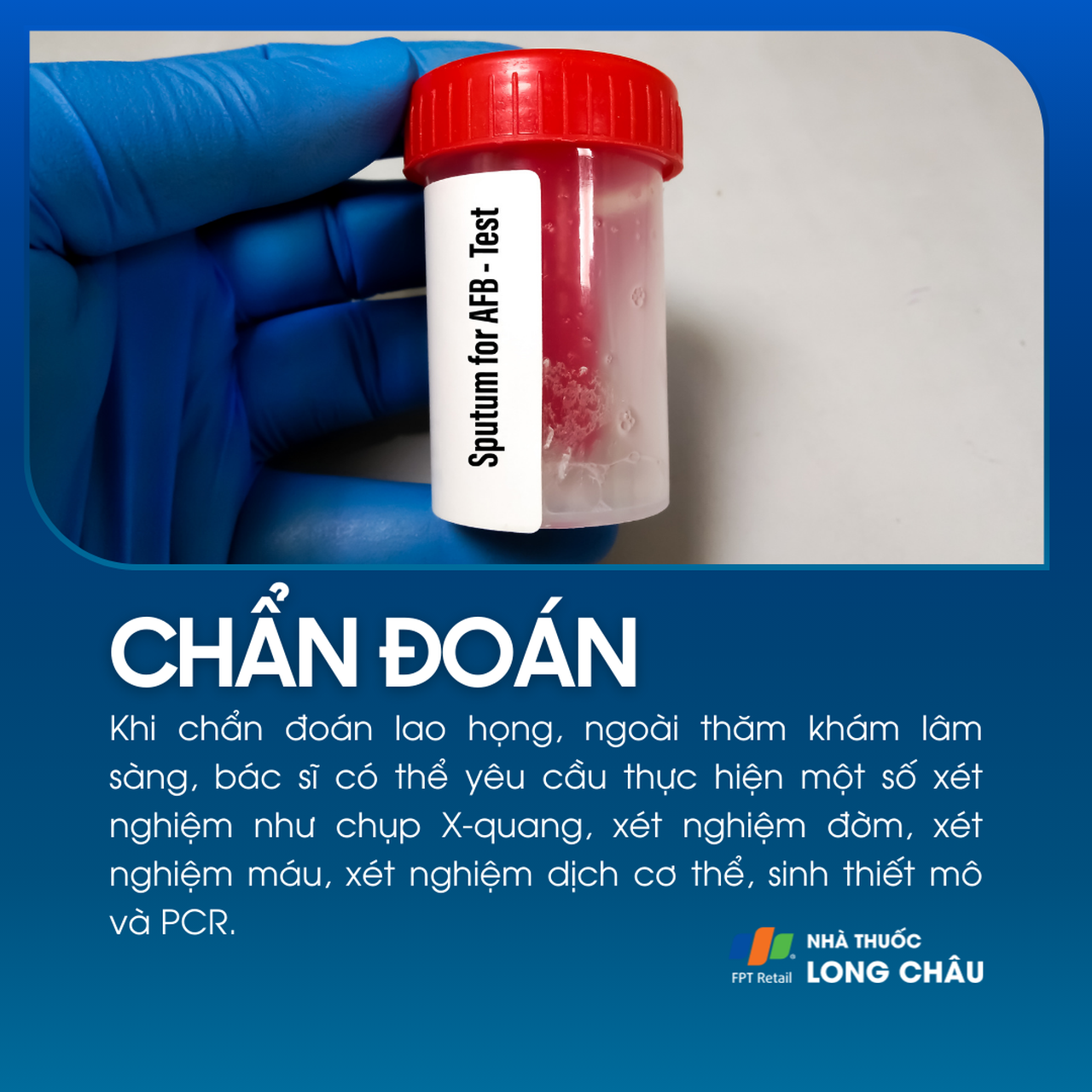 Lao họng 5