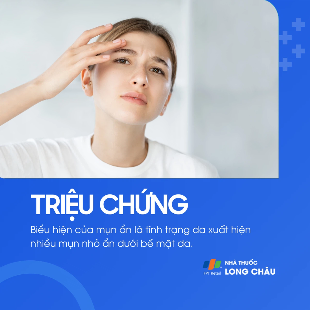 Mụn ẩn 2