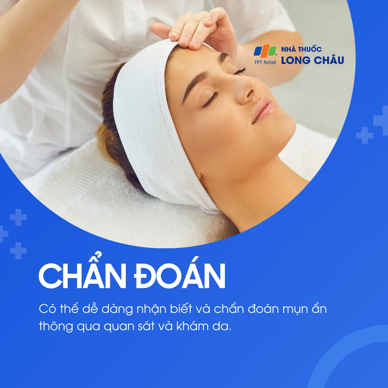 Mụn ẩn 5
