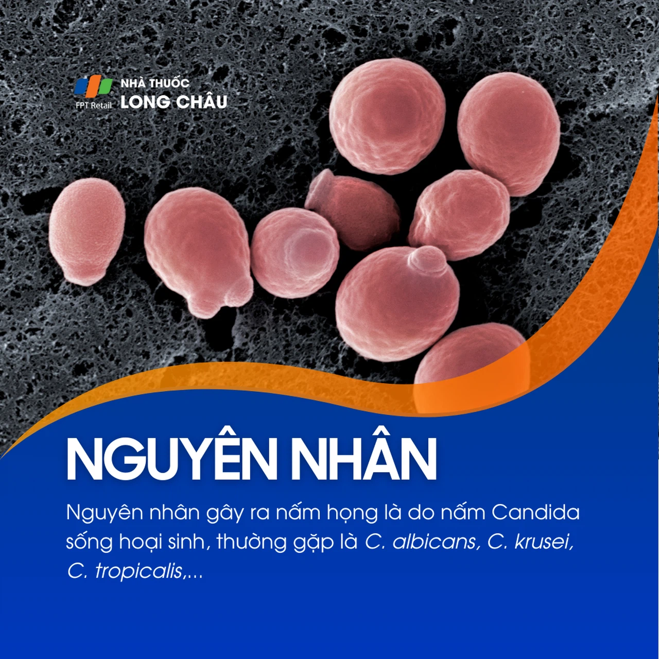 Nấm họng 3