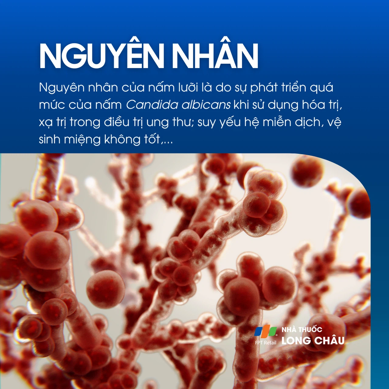 Nấm lưỡi 3